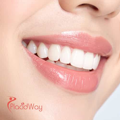 Cosmetic Dentistry in Turkey for Toronto & Markham Patients